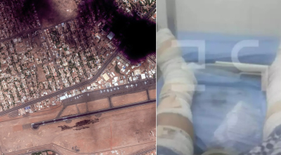 Σουδάν: Φωτογραφία ντοκουμέντο από τα τραύματα του Έλληνα που χτυπήθηκε από ρουκέτα