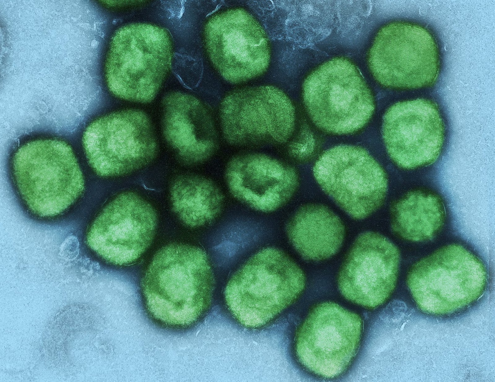 Colorized transmission electron micrograph of monkeypox virus particles green