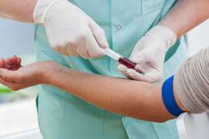 Περιστέρι: Δωρεάν εξετάσεις για HIV Ηπατίτιδες B και C