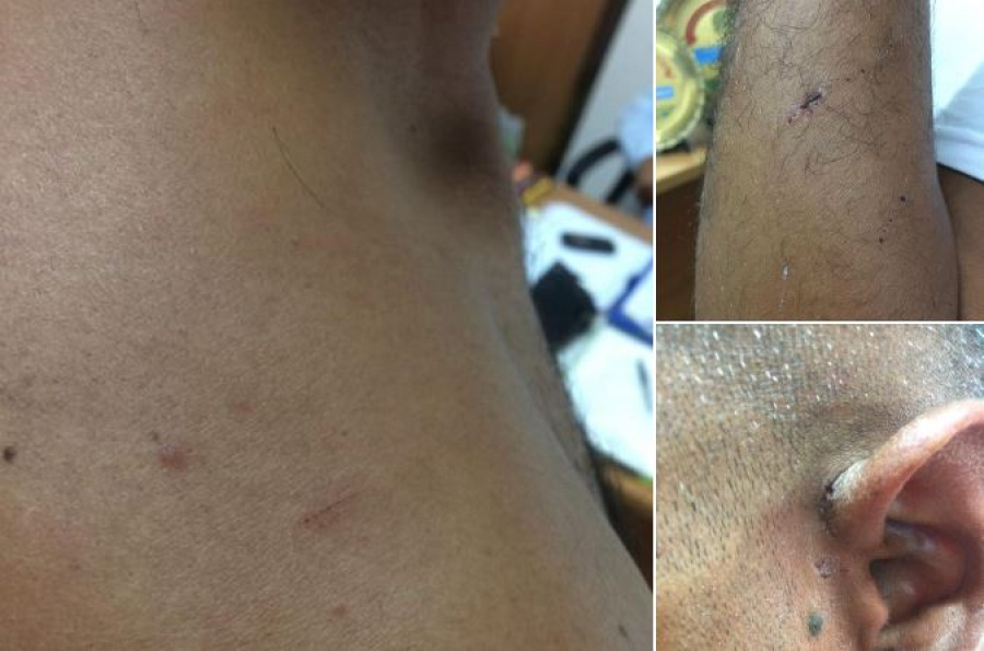 ΚΕΕΡΦΑ: Αφεντικό στη Σίφνο ξυλοκόπησε μετανάστη γιατί ζήτησε τα δεδουλευμένα του