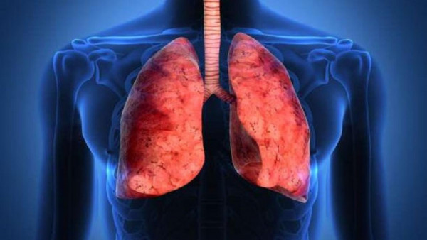 Έλληνας καθηγητής του Johns Hopkins αναλύει τις επιπτώσεις του κορονοϊού στους πνεύμονες (vid)