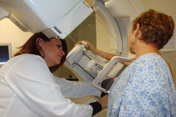 ΚΕΔΕ: 1.188 γυναίκες συμμετείχαν στο πρόγραμμα δωρεάν μαστογραφικών ελέγχων