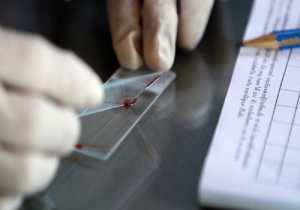 Καθησυχάζει το ΚΕΕΛΠΝΟ για τα κρούσματα ελονοσίας - Όσα πρέπει να ξέρετε