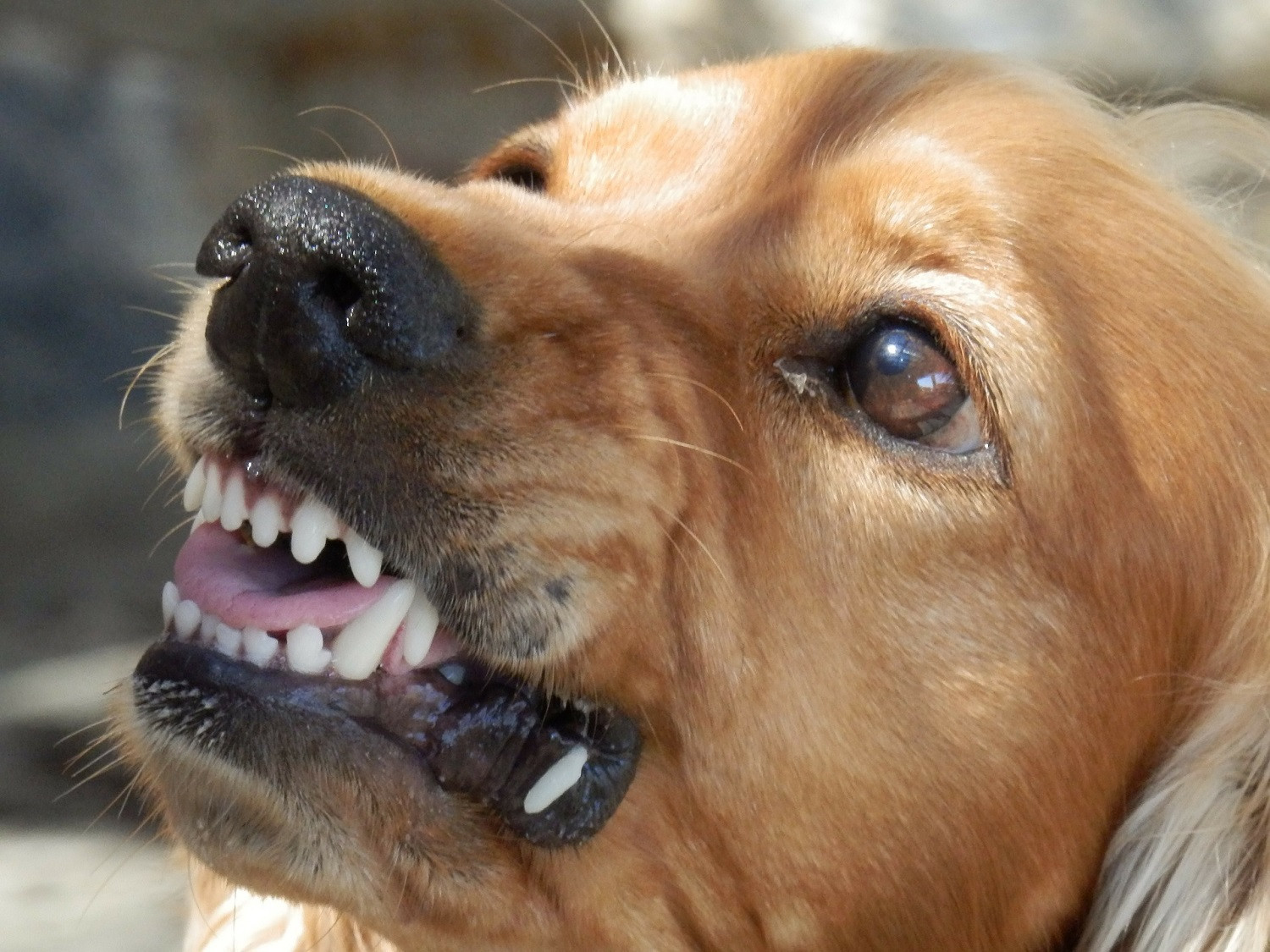 Σέρρες: Σκύλος επιτέθηκε σε 11χρονο - Πολίτες έβγαλαν το πόδι του από το στόμα του (pic)