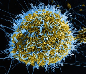 Ανακαλύφθηκαν δύο γιγάντιοι ιοί με τις μεγαλύτερες ουρές και τα περισσότερα γονίδια για δημιουργία πρωτεϊνών σε ιό