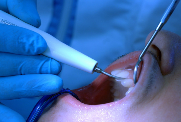 Κορονοϊος: Σε ποιες περιπτώσεις μπορείτε να απευθύνεστε στον οδοντίατρο