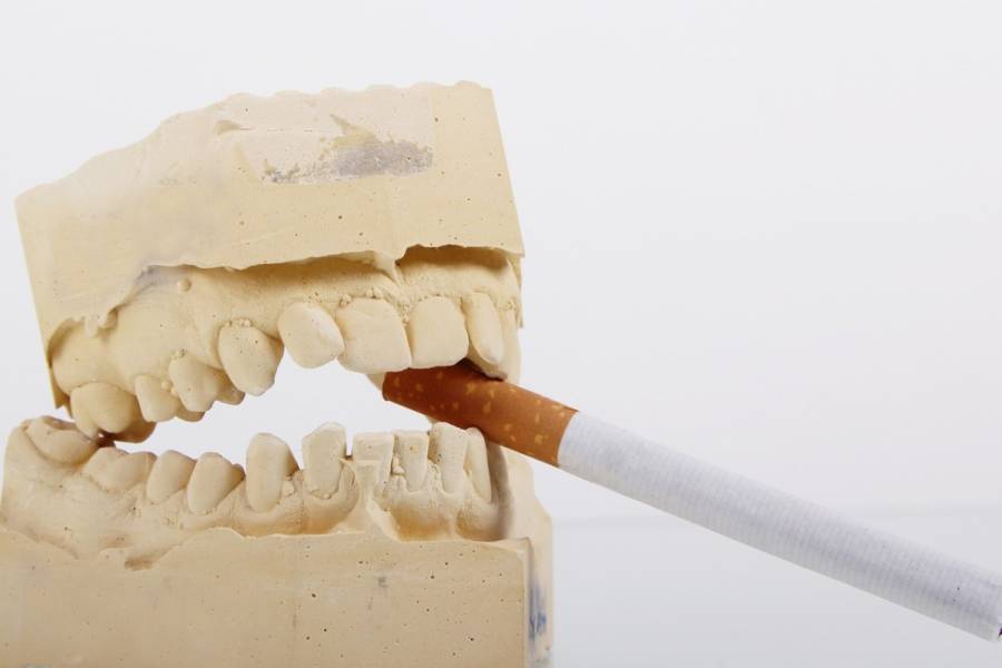 Κάπνισμα: Η ανεπανόρθωτη ζημιά που προκαλεί στα δόντια σου