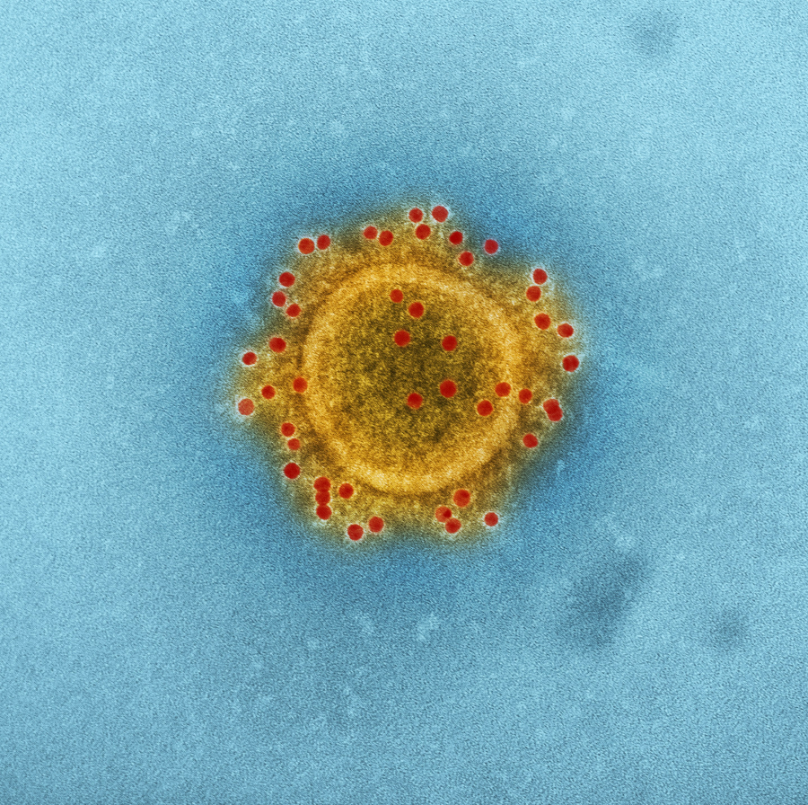Αυτός είναι ο ιός που είναι σχεδόν βέβαιο πως σας έχει μολύνει