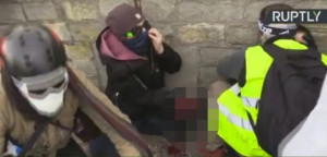 Ένταση στο Παρίσι: Διαδηλωτής από τα Κίτρινα Γιλέκα έχασε το χέρι του - Εικόνες φρίκης
