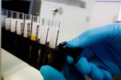 Αλέξανδρος Ζαφειρόπουλος: «Η μετάλλαξη από την Μποτσουάνα μπορεί να αχρηστεύσει εμβόλια και μονοκλωνικά αντισώματα» (βίντεο)