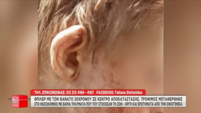 Θεσσαλονίκη: Από εγκεφαλική αιμορραγία πέθανε ο 20χρονος που ξυλοκοπήθηκε στο κέντρο αποκατάστασης