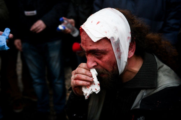 Η ανακοίνωση της ΕΡΤ για τον τραυματισμό δημοσιογράφου στα επεισόδια στο συλλαλητήριο