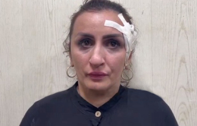 Αδιανόητο περιστατικό στη Βρετανία, μητέρα πούλησε το νεογέννητο παιδί της για να κάνει πλαστική στη μύτη (βίντεο)
