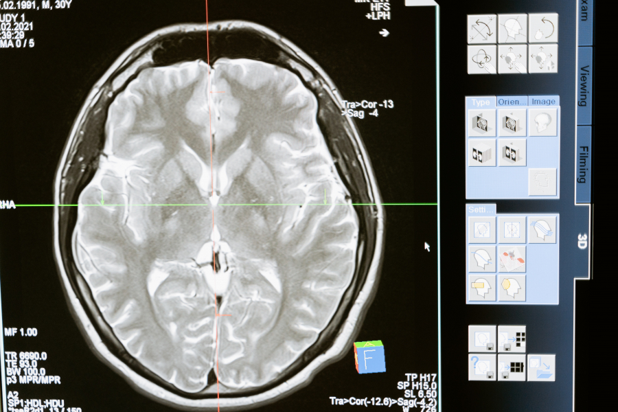 «Έξυπνοι» νανομεταφορείς θεραπεύουν στοχευόμενα, ακόμη και τον καρκίνο εγκεφάλου