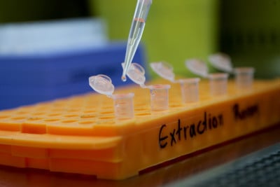Κορονοϊός: Ξεκίνησε η κλινική δοκιμή του εμβολίου BriLife σε ανθρώπους