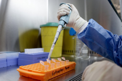 Κορονοϊός - Moderna: Ποια θα είναι η τιμή του εμβολίου, σύμφωνα με το Reuters