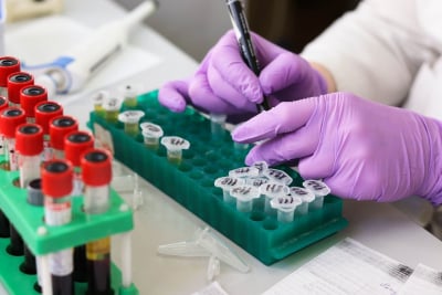 Βρέθηκε «αόρατη» εκδοχή της μετάλλαξης Όμικρον δεν ανιχνεύεται ούτε με PCR