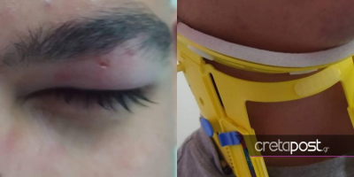 Κρήτη: Οδηγός ξυλοκόπησε μαθητή επειδή του έκανε παρατήρηση για τη διάβαση πεζών