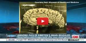 Οι εικόνες από τον εγκέφαλο του Αϊνστάιν αποκαλύπτουν τους λόγους της ευφυΐας του