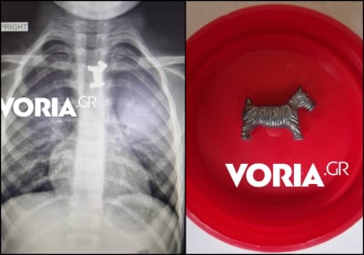Αγοράκι κατάπιε μεταλλικό σκυλάκι από γνωστό παιχνίδι: Το έσωσαν οι γιατροί στο Ιπποκράτειο