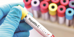Φάρμακα: Μέχρι το τέλος του έτους η τιμή για την ηπατίτιδα C - Ορίστηκε η Επιτροπή Διαπραγμάτευσης