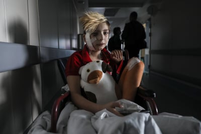 «Δεν νομίζω ότι θα ήθελε κανείς να δει όσα βλέπουμε εμείς»: Κραυγή αγωνίας από τους γιατρούς που περιθάλπουν παιδιά στην Ουκρανία