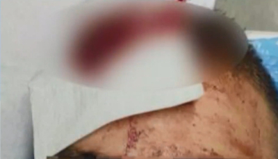 Ατύχημα στο Allu Fun Park: Σοκάρουν οι εικόνες από τα τραυματισμένα παιδιά (βίντεο)