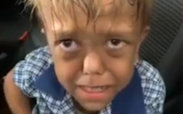 Αγόρι με νανισμό σπαράζει στο κλάμα λόγω bullying: «Δώστε μου μαχαίρι να πεθάνω»