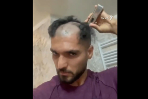 Ιράν: Ποδοσφαιριστής ξύρισε το κεφάλι του σε ένδειξη συμπαράστασης των γυναικών της χώρας (βίντεο)