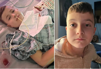 Αφαιρέθηκε όγκος σε μέγεθος αυγού από την γνάθο του 9χρονου Δημήτρη, το αντικατέστησαν με κόκαλα από το πόδι (εικόνες)